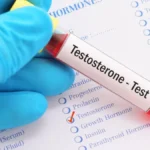 Hormon Testosteron dan Perannya yang Sangat Vital bagi Tubuh