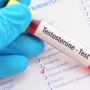 Hormon Testosteron dan Perannya yang Sangat Vital bagi Tubuh