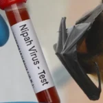 Ciri Penyakit Nipah yang Perlu Diwaspadai dari Gejala Awalnya