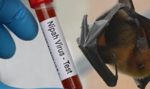 Ciri Penyakit Nipah yang Perlu Diwaspadai dari Gejala Awalnya